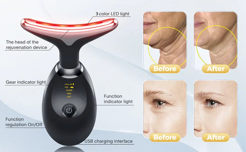 Anti Wrinkle Beauty Apparatus SmartNest